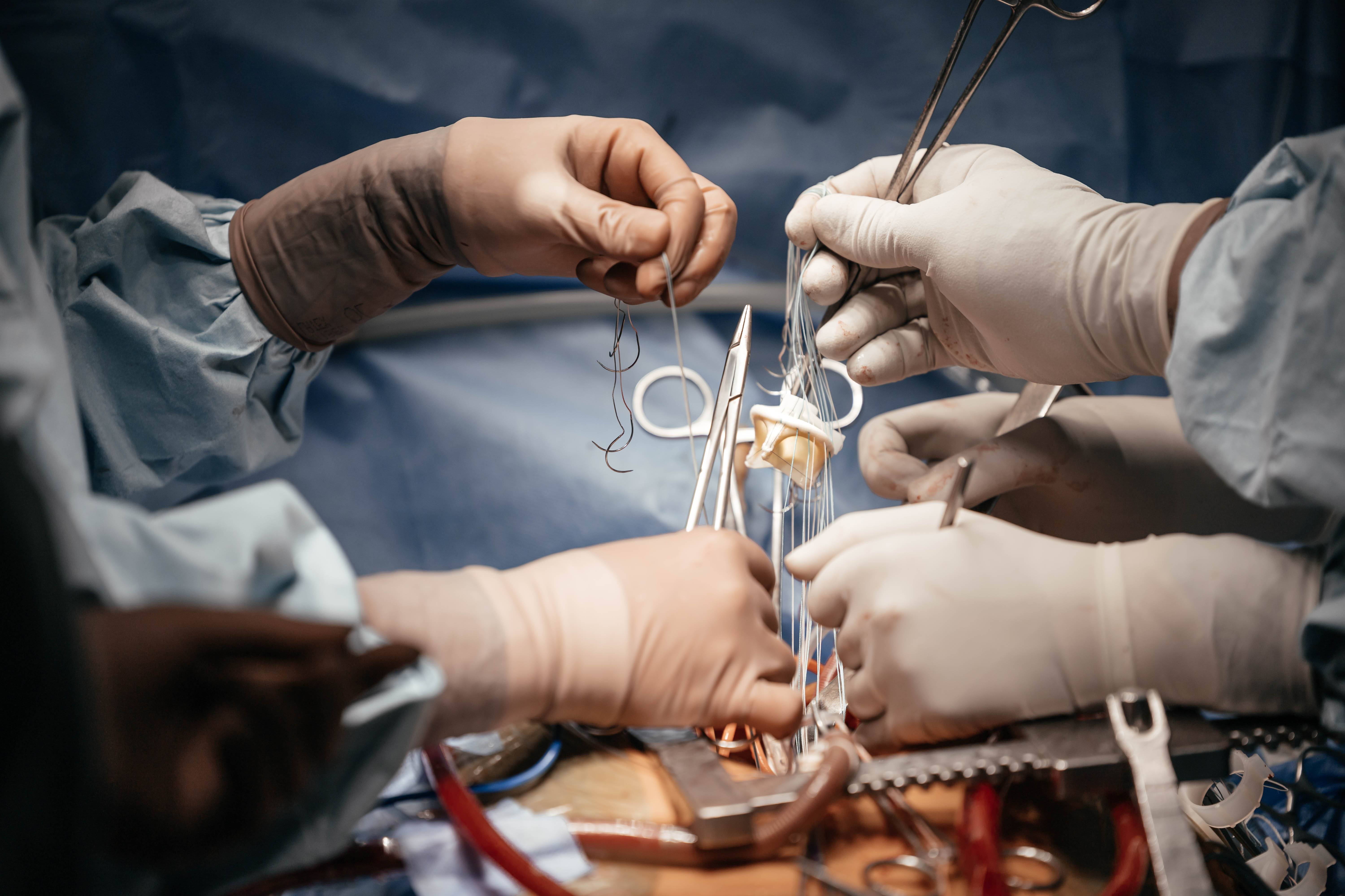 Åben hjerteoperation med indsættelse af kunstige hjerteklapper. 